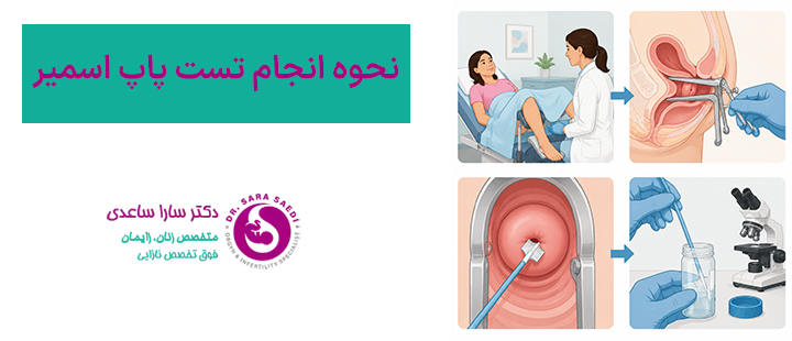 نحوه انجام تست پاپ اسمیر