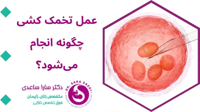 تخمک کشی در آی وی اف