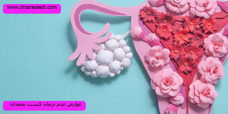 عوارض-عدم-درمان-کیست-تخمدان