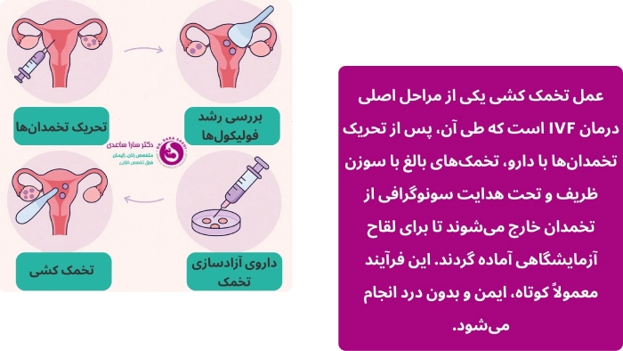 مراحل تخمک کشی