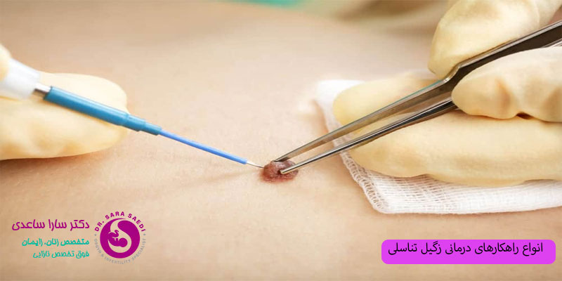انواع-راهکارهای-درمانی-زگیل-تناسلی