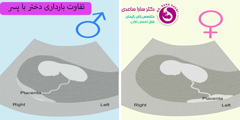 تفاوت-بارداری-دختر-با-پسر