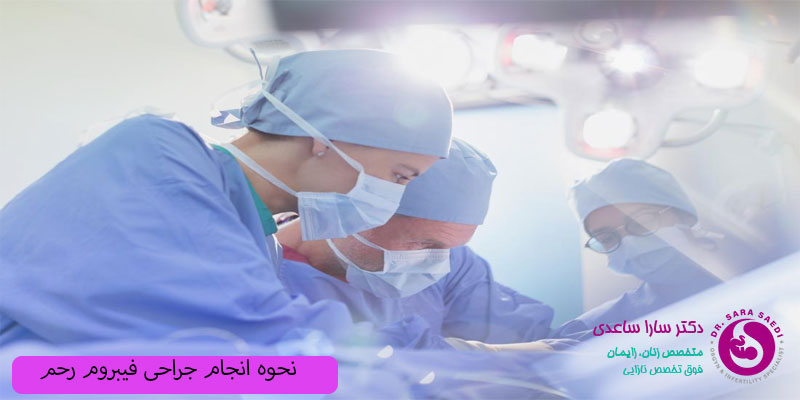 نحوه انجام جراحی فیبروم رحم
