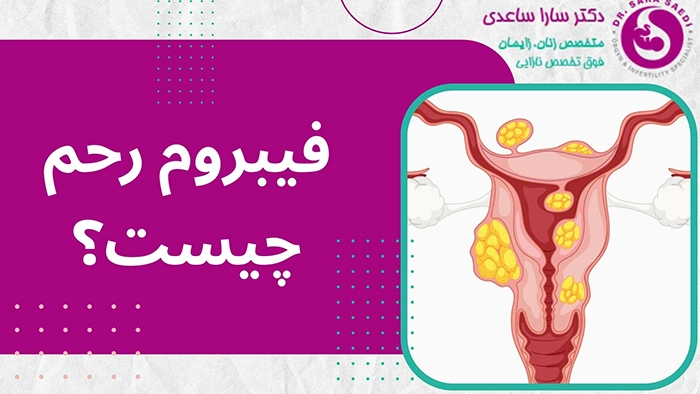 فیبروم رحم