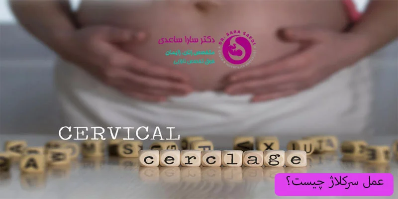 عمل-سرکلاژ-چیست؟