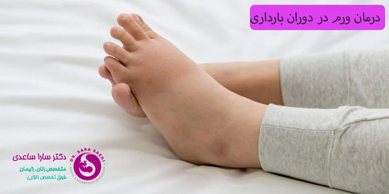 درمان-ورم-در-دوران-بارداری