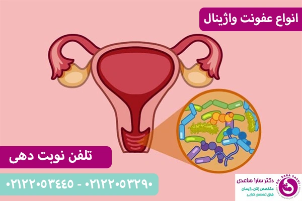 انواع عفونت واژن