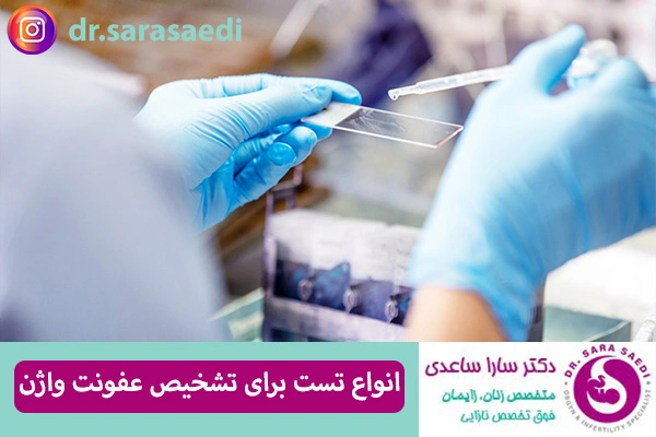 تست تشخیص عفونت واژن