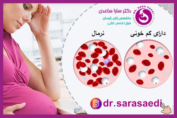 تغذیه بارداری و تاثیر آن بر کم خونی