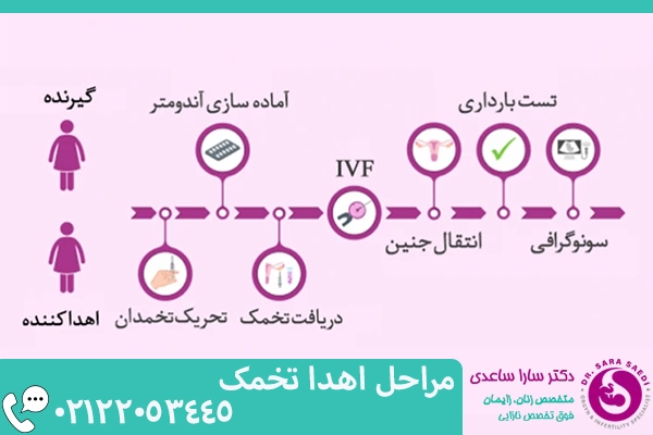 مراحل اهدا تخمک