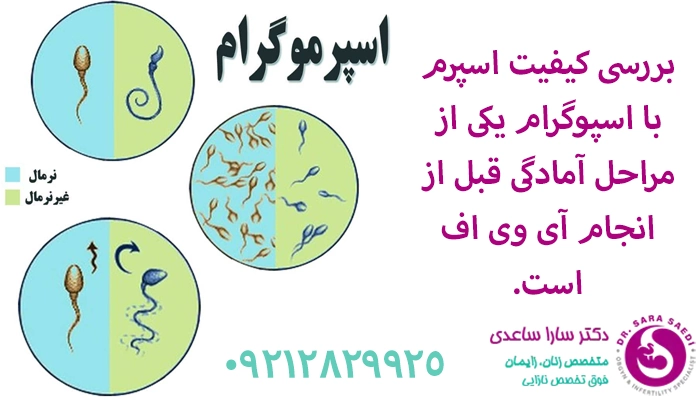 اسپرموگرام از مراحل لازم قبل از آی وی اف