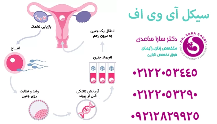 آمادگی لازم قبل از شروع سیکل آی وی اف