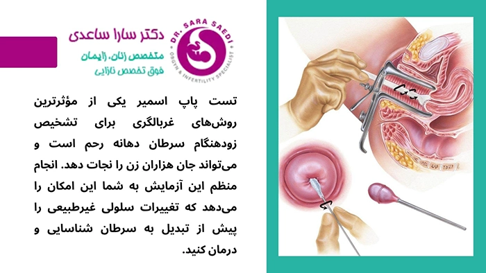 پاپ اسمیر