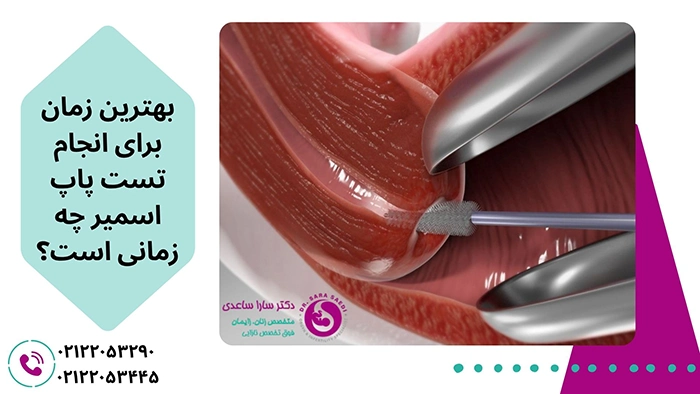 بهترین زمان تست پاپ اسمیر