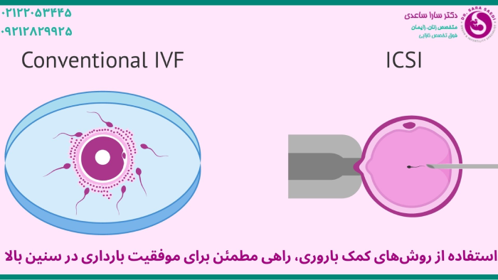 راههای کمک باروری برای بارداری در سن بالا